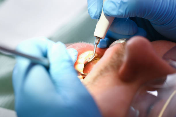 Best Emergency Treatment for Toothache in Mallory, WV